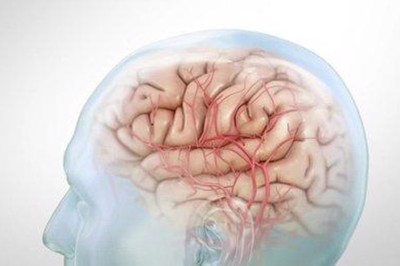 Dấu hiệu đột quỵ não: 10 triệu chứng nhất định bạn phải biết